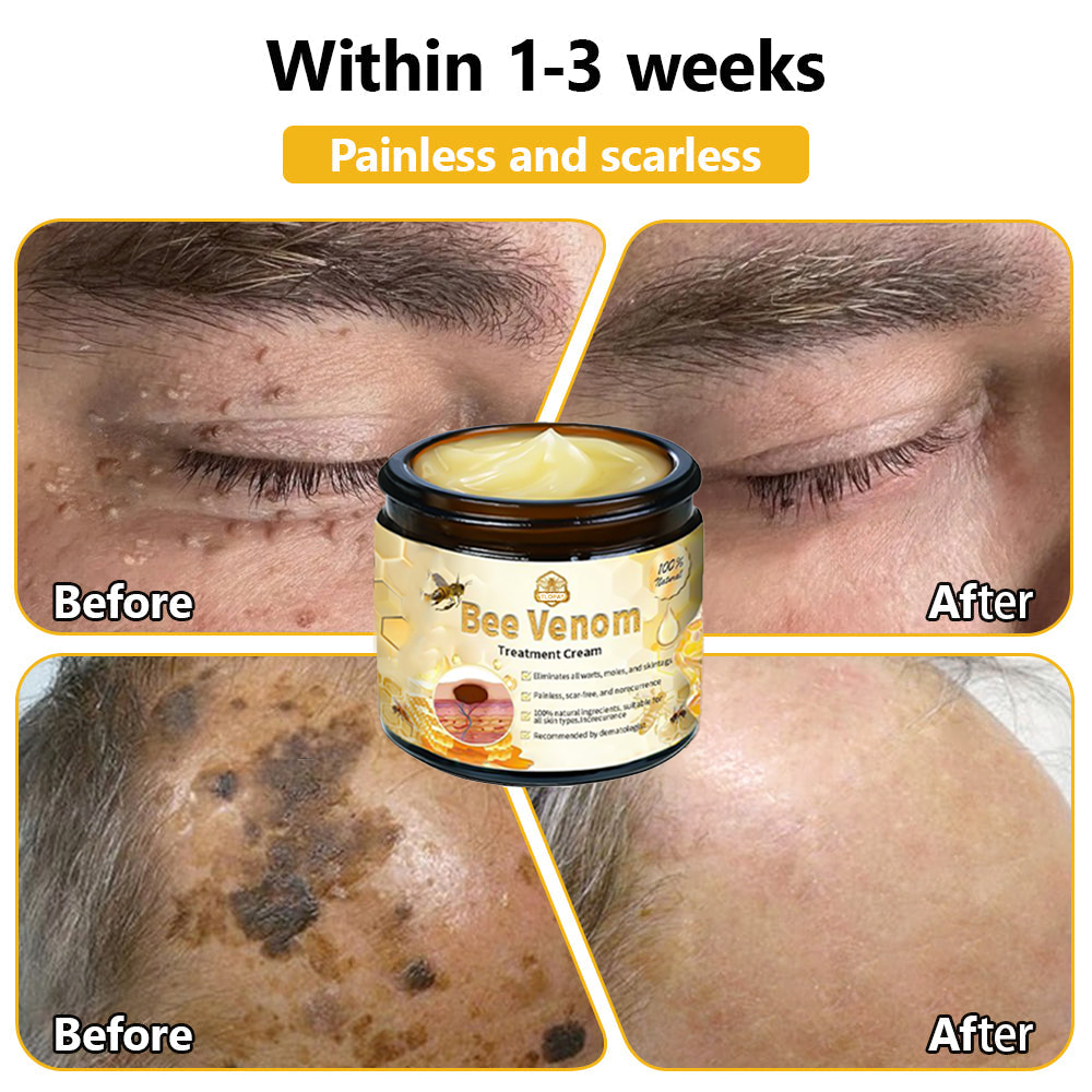 Skin tested certification | 𝙏𝙇𝙊𝙋𝘼™ Bee Venom Skin Treatment Cream (AAD Recommended) (Up to 70% off)