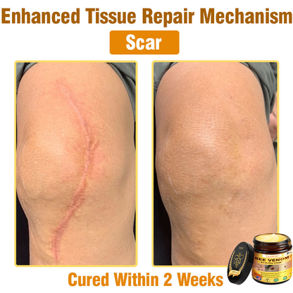 TLOPA® Bee Venom All-in-One Cream US Dermatologist Approved