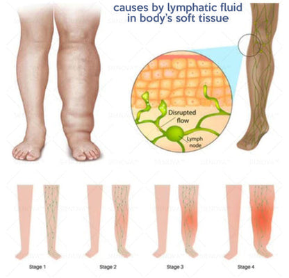 Portable Lymphatic Detox & Arthritis Treatment Device 👨‍⚕️ Original 2-in-1 Therapy | Recommended by ESPT ✅