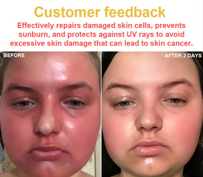 TLOPA® Bee Venom Skin Cream（👨‍⚕AAD Recommended),for Remove Warts, Acne and Scars ✅