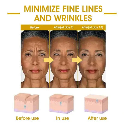 Last Day Sale: 70% OFF ✨ TLOPA® SkinFirming Rejuvenating Oil 💧
