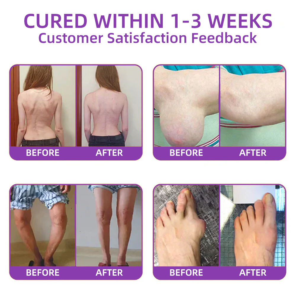 𝐎𝐟𝐟𝐢𝐜𝐢𝐚𝐥 𝐒𝐭𝐨𝐫𝐞: 𝐓𝐋𝐎𝐏𝐀® 𝑺𝒉𝒂𝒓𝒌 𝑪𝒂𝒓𝒕𝒊𝒍𝒂𝒈𝒆 𝑷𝒂𝒊𝒏-𝑺𝒐𝒐𝒕𝒉𝒊𝒏𝒈 𝑩𝒐𝒏𝒆 𝑹𝒆𝒄𝒐𝒗𝒆𝒓𝒚 𝑮𝒆𝒍 👨‍⚕️𝑨𝒎𝒆𝒓𝒊𝒄𝒂𝒏 𝑨𝒄𝒂𝒅𝒆𝒎𝒚 𝒐𝒇 𝑶𝒓𝒕𝒉𝒐𝒑𝒂𝒆𝒅𝒊𝒄 𝑺𝒖𝒓𝒈𝒆𝒐𝒏𝒔 (𝑨𝑨𝑶𝑺) 𝒓𝒆𝒄𝒐𝒎𝒎𝒆𝒏𝒅 (𝟧-𝗆𝗂𝗇𝗎𝗍𝖾 𝗉𝖺𝗂𝗇 𝗋𝖾𝗅𝗂𝖾𝖿, 𝟩 𝖽𝖺𝗒𝗌 𝗍𝗈 𝗋𝖾𝗌𝗍𝗈𝗋𝖾 𝗃𝗈𝗂𝗇𝗍 𝗆𝗈𝖻𝗂𝗅𝗂𝗍𝗒, 𝟦 𝗐𝖾𝖾𝗄𝗌 𝖿𝗈𝗋 𝖼𝗈𝗆𝗉𝗅𝖾𝗍𝖾 𝗁𝖾𝖺𝗅𝗂𝗇𝗀)