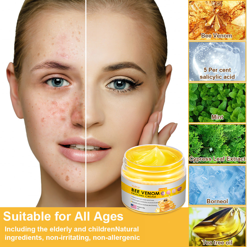 TLOPA® Bee Venom Skin Cream（👨‍⚕AAD Recommended),for Remove Warts, Acne and Scars ✅