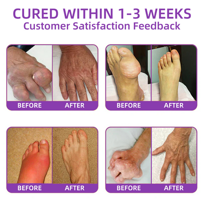 Official Store: TLOPA® Turmeric & Emu Oil Arthritis Soothing Pain Relief Massage Gel 👨‍⚕️Recommended by the American Academy of Orthopaedic Surgeons ✅