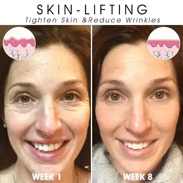 Last Day Sale: 70% OFF ✨ TLOPA® SkinFirming Rejuvenating Oil 💧