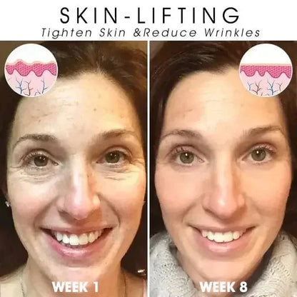 Last Day Sale: 70% OFF ✨ TLOPA® SkinFirming Rejuvenating Oil 💧