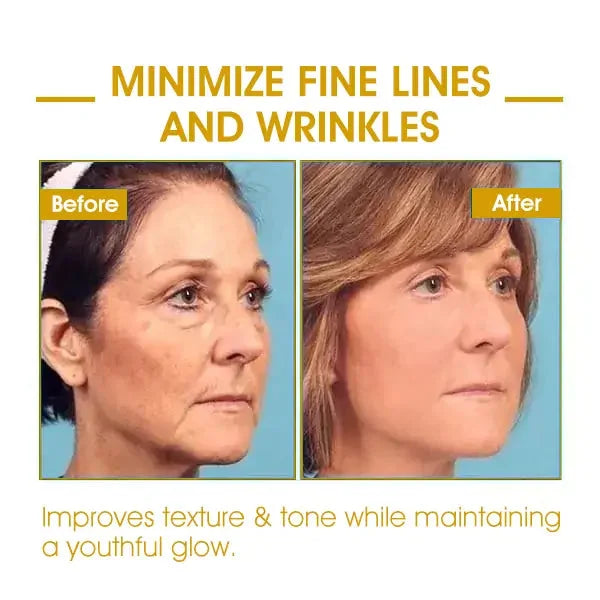 Last Day Sale: 70% OFF 💧 TLOPA® SkinFirming Rejuvenating Oil 💧