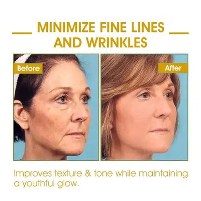 Last Day Sale: 70% OFF 💧 TLOPA® SkinFirming Rejuvenating Oil 💧