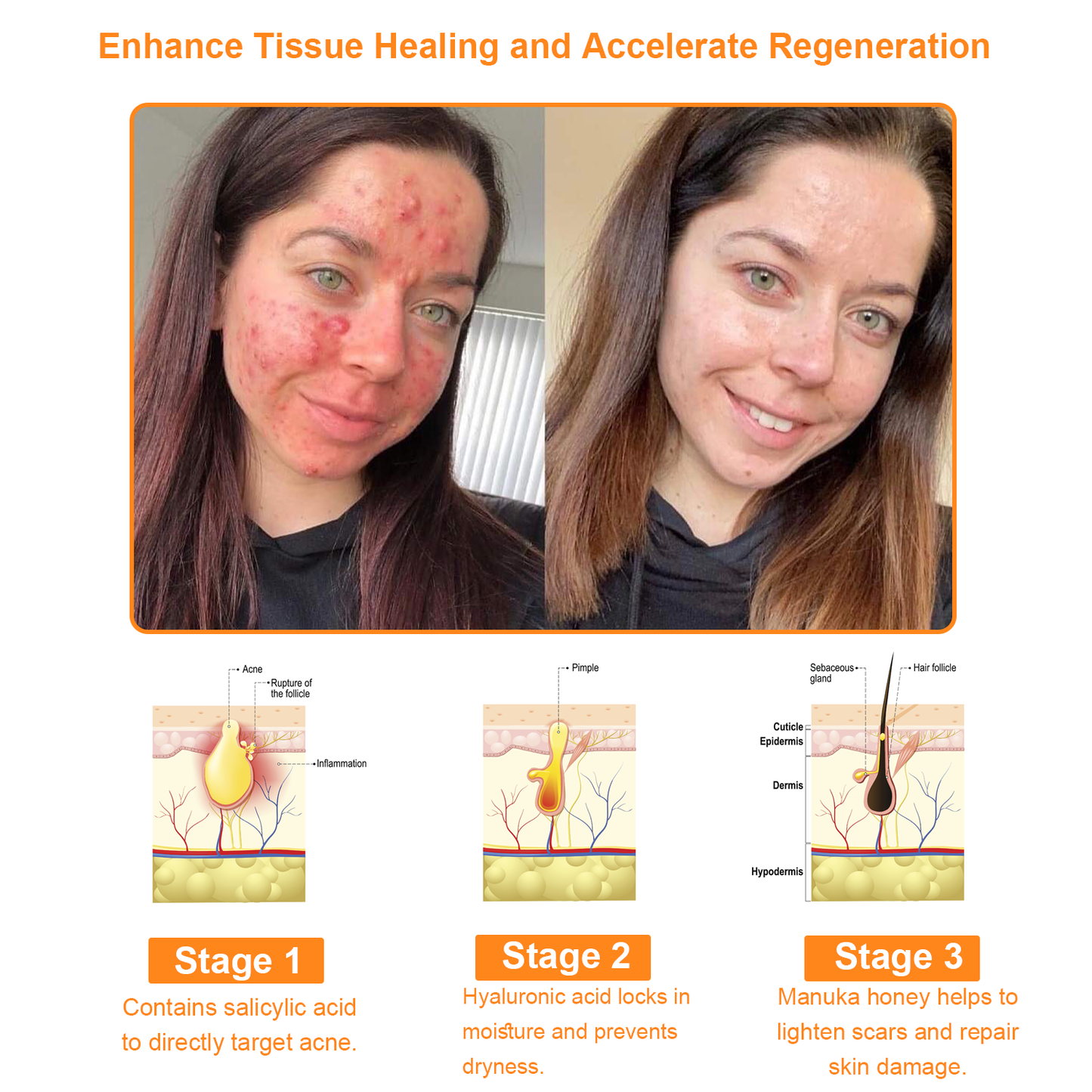 𝗧𝗟𝗢𝗣𝗔™ Powerful All-Body Skin Treatment Cream (AAD Recommended)🥑
