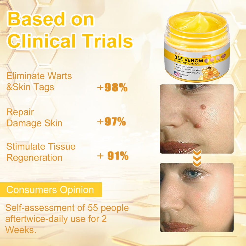 TLOPA® Bee Venom Skin Cream（👨‍⚕AAD Recommended),for Remove Warts, Acne and Scars ✅