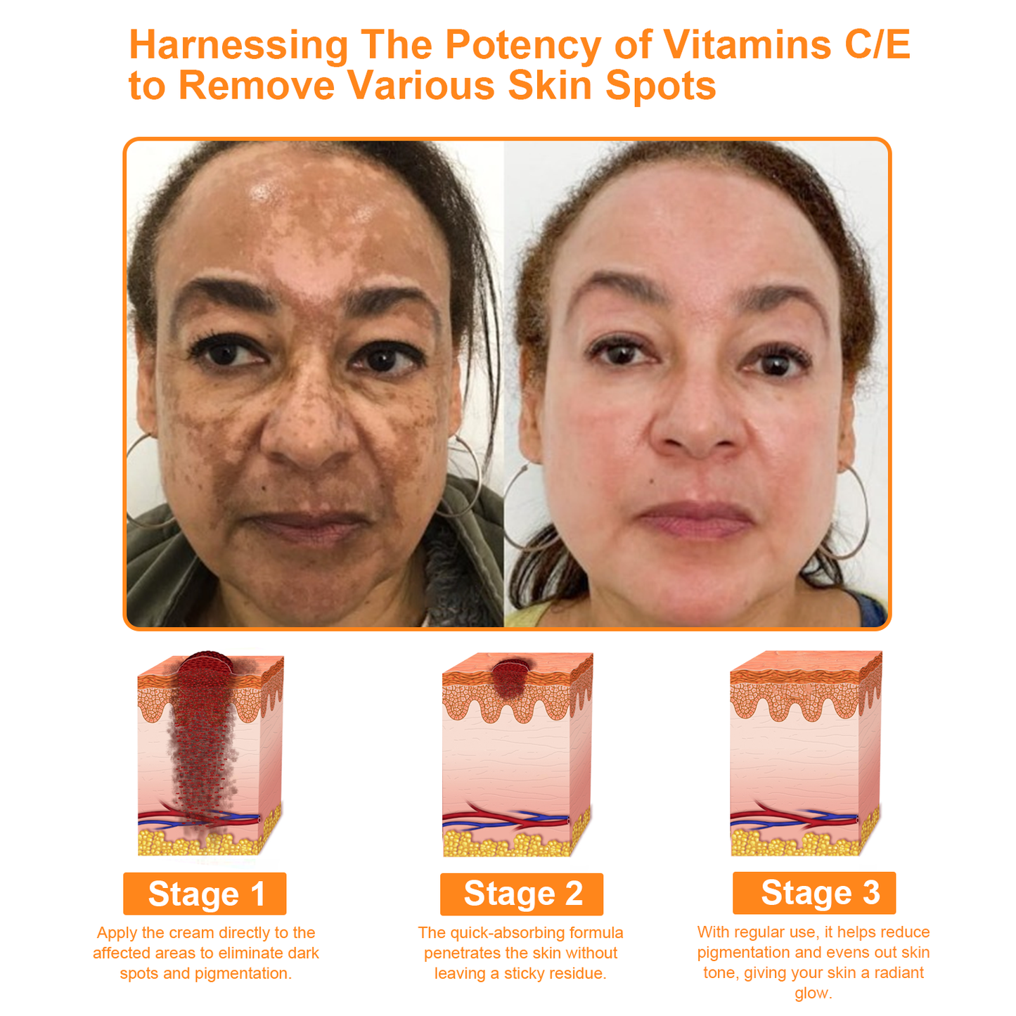 𝗧𝗟𝗢𝗣𝗔™ Powerful All-Body Skin Treatment Cream (AAD Recommended)🥑