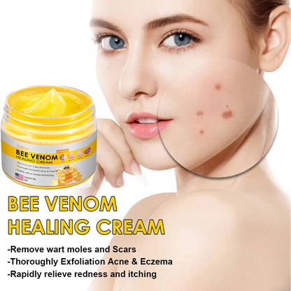 TLOPA® Bee Venom Skin Cream（👨‍⚕AAD Recommended),for Remove Warts, Acne and Scars ✅