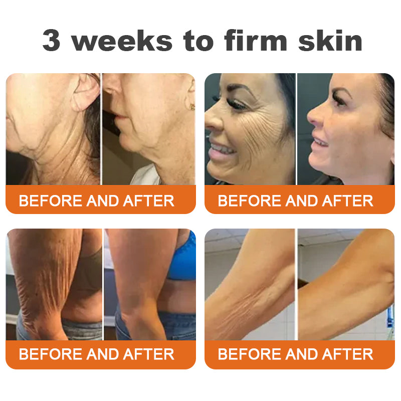 Made and Shipped from USA✨TLOPA® Botox Bee Venom Firming Serum Stick(🔥LAST DAY 70% OFF)✨
