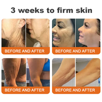 Made and Shipped from USA✨TLOPA® Botox Bee Venom Firming Serum Stick(🔥LAST DAY 70% OFF)✨