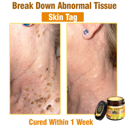 TLOPA® Bee Venom All-in-One Cream US Dermatologist Approved