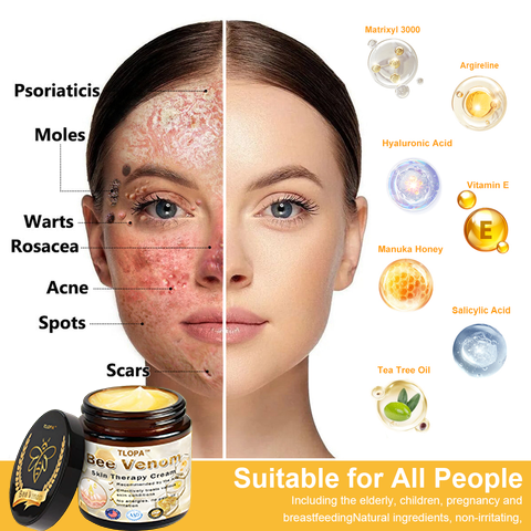𝗧𝗟𝗢𝗣𝗔™ Powerful All-Body Skin Treatment Cream (AAD Recommended)
