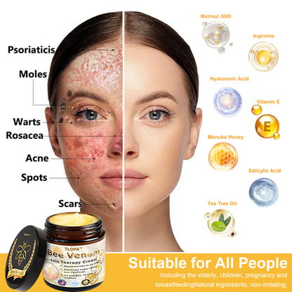 𝗧𝗟𝗢𝗣𝗔™ Powerful All-Body Skin Treatment Cream (AAD Recommended)