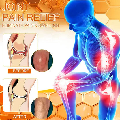 Official Store: TLOPA® Bee-Venom Pain-Relief Bone Healing Cream👨‍⚕️USA Osteopathic Medical Association （AAOS）Approved(Reducing joint swelling, pain, stiffness, redness, warmth, soreness, and joint fatigue)