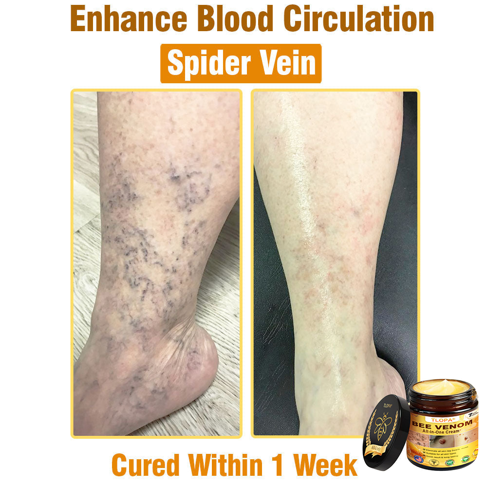 TLOPA® Bee Venom All-in-One Cream US Dermatologist Approved