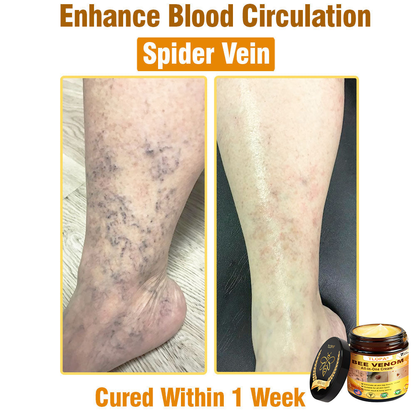 TLOPA® Bee Venom All-in-One Cream US Dermatologist Approved