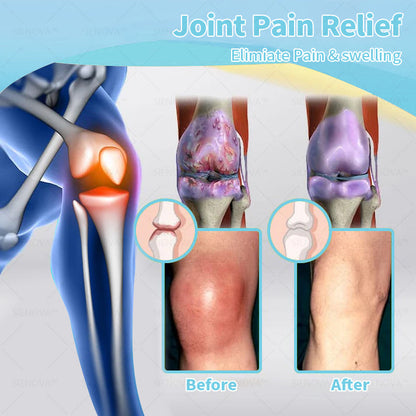 Portable Lymphatic Detox & Arthritis Treatment Device 👨‍⚕️ Original 2-in-1 Therapy | Recommended by ESPT ✅