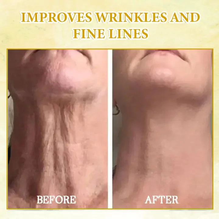 Last Day Sale: 70% OFF ✨ TLOPA® SkinFirming Rejuvenating Oil 💧