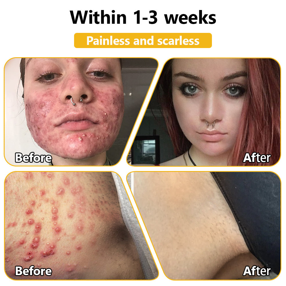 Skin tested certification | 𝙏𝙇𝙊𝙋𝘼™ Bee Venom Skin Treatment Cream (AAD Recommended) (Up to 70% off)