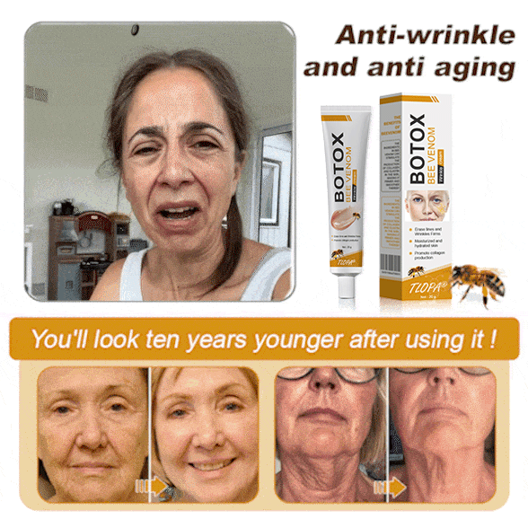 (Made and Shipped from USA) 🧑‍⚕️TLOPA® Botox Bee Venom Wrinkle Removal Cream- LAST DAY 70% OFF💧