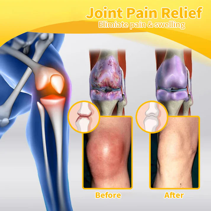 Official Store: TLOPA® Bee-Venom Pain-Relief Bone Healing Cream👨‍⚕️USA Osteopathic Medical Association （AAOS）Approved(Reducing joint swelling, pain, stiffness, redness, warmth, soreness, and joint fatigue)