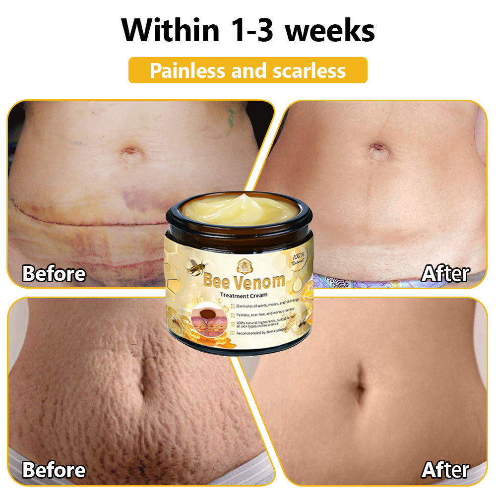 Skin tested certification | 𝙏𝙇𝙊𝙋𝘼™ Bee Venom Skin Treatment Cream (AAD Recommended) (Up to 70% off)