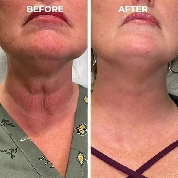 Last Day Sale: 70% OFF ✨ TLOPA® SkinFirming Rejuvenating Oil 💧