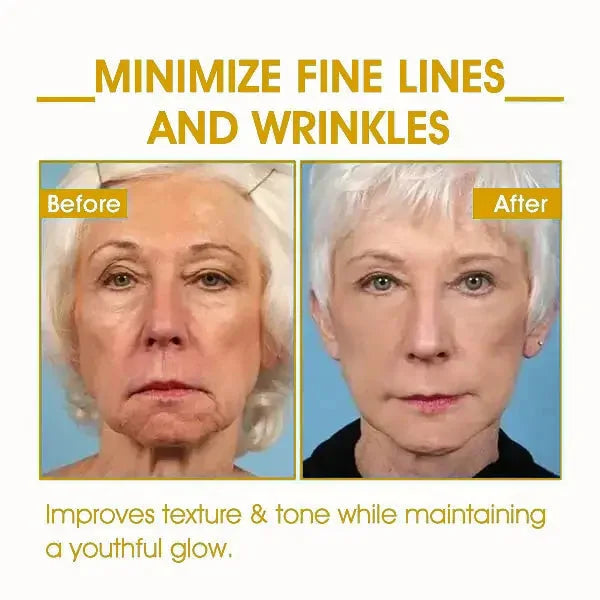 Last Day Sale: 70% OFF ✨ TLOPA® SkinFirming Rejuvenating Oil 💧