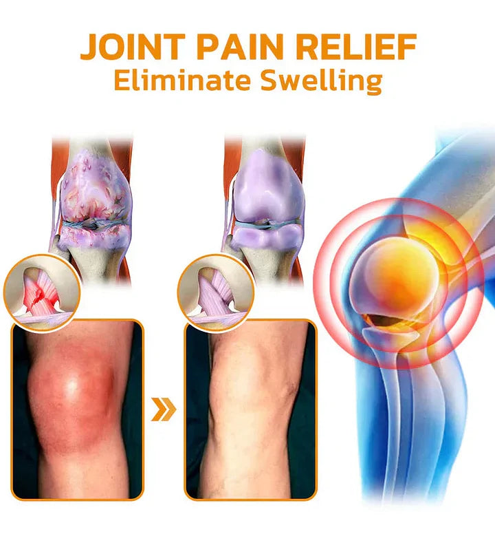 Official Store: TLOPA® Bee-Venom Pain-Relief Bone Healing Cream👨‍⚕️USA Osteopathic Medical Association （AAOS）Approved(Reducing joint swelling, pain, stiffness, redness, warmth, soreness, and joint fatigue)