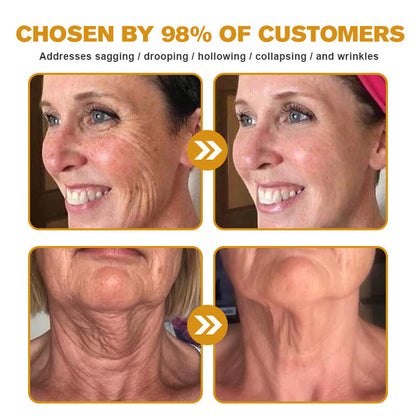 (Made and Shipped from USA) 🧑‍⚕️TLOPA® Botox Bee Venom Wrinkle Removal Cream- LAST DAY 70% OFF💧