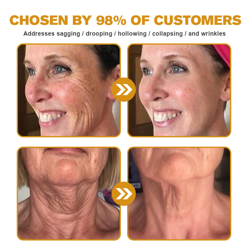 (Made and Shipped from USA) 🧑‍⚕️TLOPA® Botox Bee Venom Wrinkle Removal Cream- LAST DAY 70% OFF🔥
