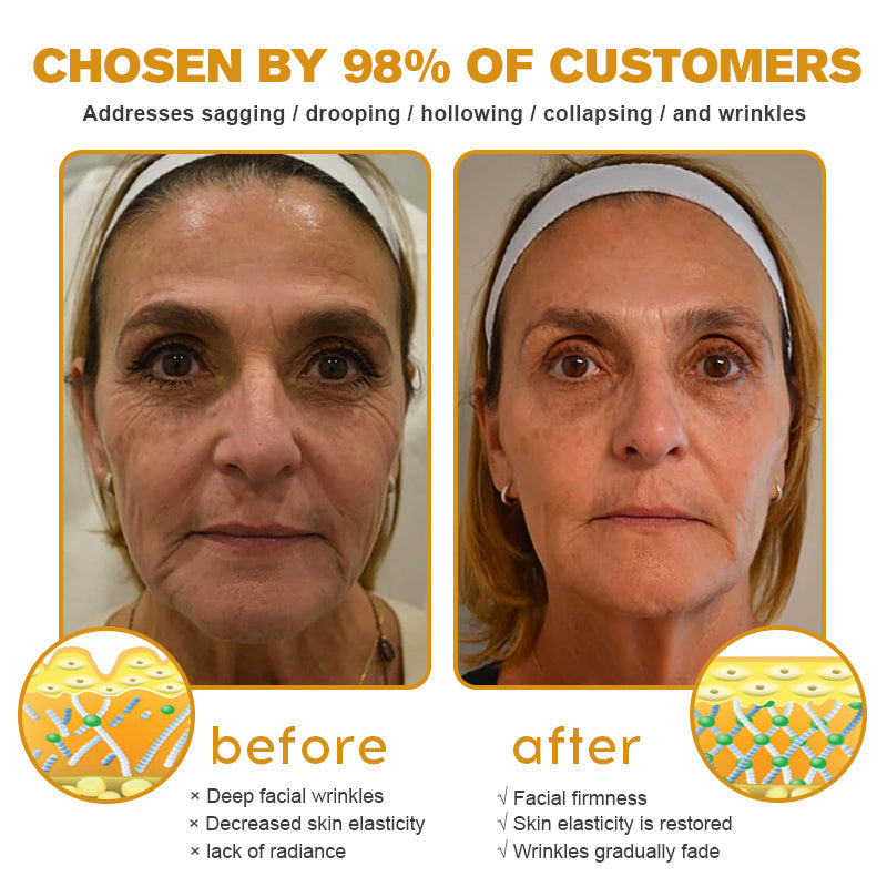 (Made and Shipped from USA) 🧑‍⚕️TLOPA® Botox Bee Venom Wrinkle Removal Cream- LAST DAY 70% OFF💧